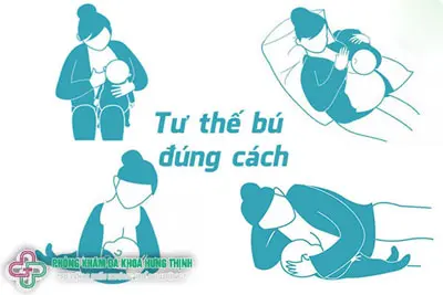 Các tư thế cho con bú đúng cách