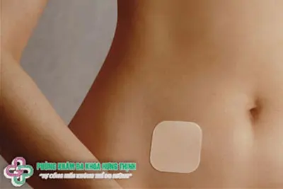 Miếng dán tránh thai là gì?