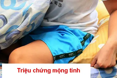 Triệu chứng mộng tinh