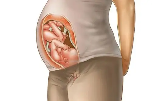 Cơ thể mẹ bầu ở tuần thứ 37
