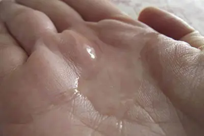 Tinh trùng loãng là gì?