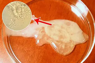 Tinh trùng yếu có biểu hiện gì?