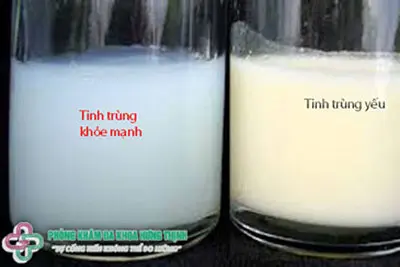 Làm sao biết tinh trùng yếu?