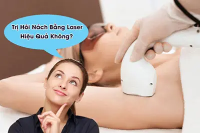 Cách điều trị hôi nách bằng laser