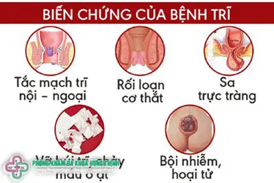 Những biến chứng của bệnh trĩ