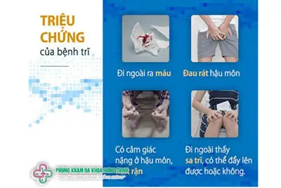 Dấu hiệu, triệu chứng bệnh trĩ