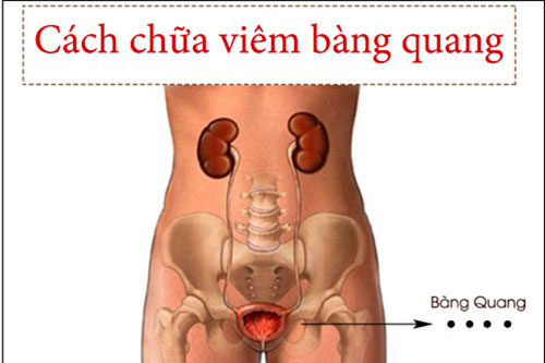 Cách điều trị viêm bàng quang