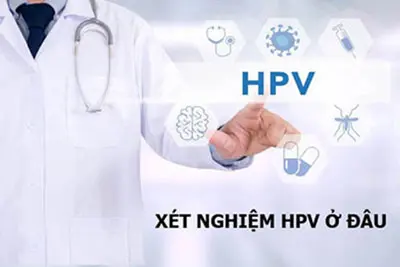 Xét nghiệm HPV ở đâu tốt?