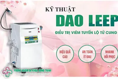 Chữa viêm lộ tuyeến cổ tử cung bằng phương pháp dao LEEP