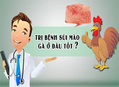Khám bệnh sùi mào gà ở đâu tốt