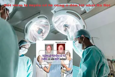 Địa chỉ đốt viêm lộ tuyến cổ tử cung ở đâu tốt?