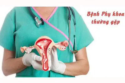 Bệnh phụ khoa thường gặp ở phụ nữ