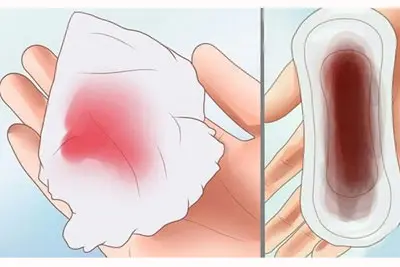 Xuất huyết âm đạo