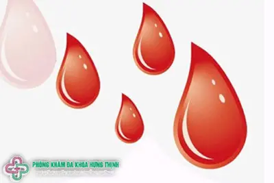 Chậm kinh 2 tháng không có kinh nguyệt phải làm sao?