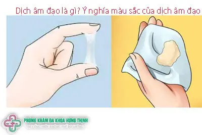Dịch âm đạo là gì?