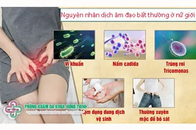 Nguyên nhân dịch âm đạo bất thường ở nữ giới