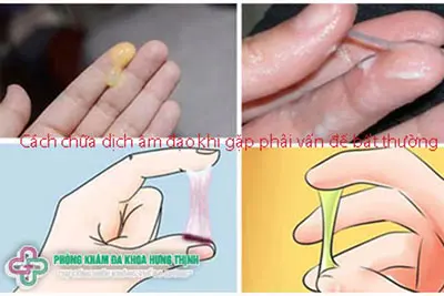 Cách chữa dịch âm đạo khi gặp phải vấn đề bất thường