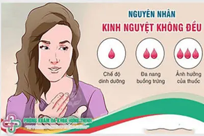 Nguyên nhân gây kinh nguyệt không đều