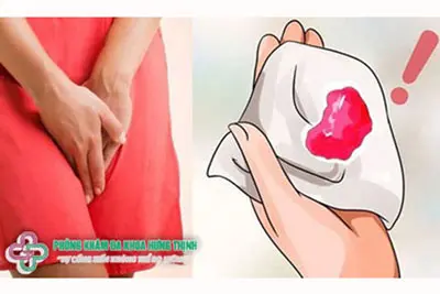 Kinh nguyệt là gì?