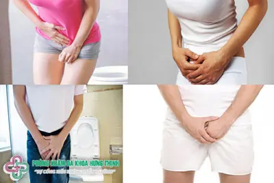 Bí tiểu lúc nào cũng có cảm giác buồn tiểu là bệnh gì?