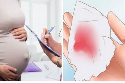 Máu báo thai sắp sinh là gì
