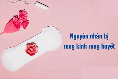 Nguyên nhân rong kinh