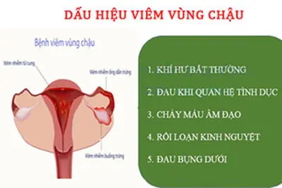 Dấu hiệu viêm vùng chậu