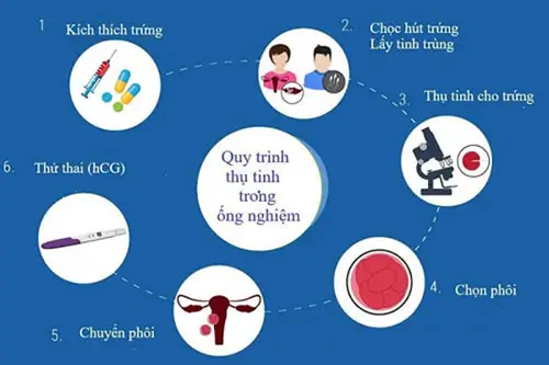 Phương pháp hiện đại điều trị vô sinh hiệu quả