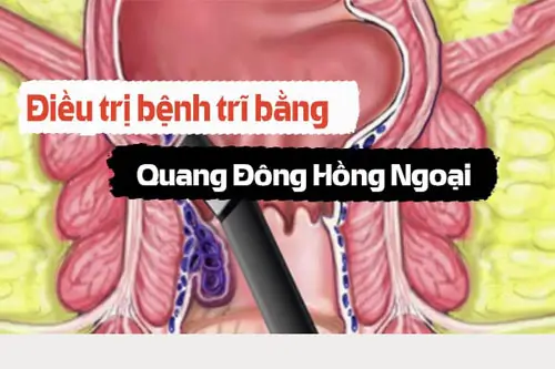 Phương pháp quang đông hồng ngoại