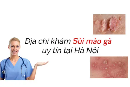 Địa chỉ khám chữa sùi mào gà an toàn
