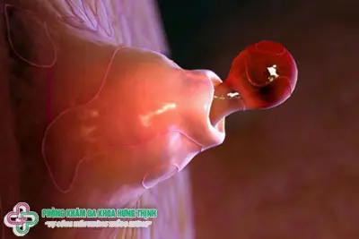 Một số dấu hiệu nhận biết quá trình rụng trứng ở nữ giới