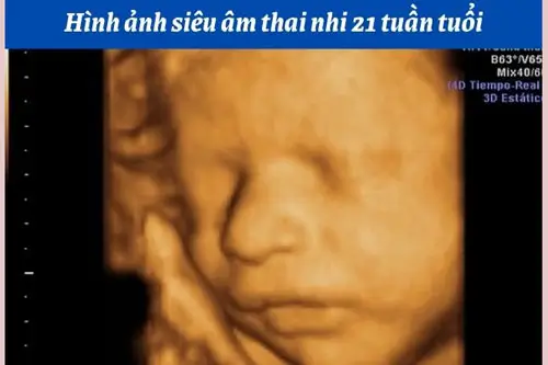 Hình ảnh, cân nặng thai 21 tuần tuổi