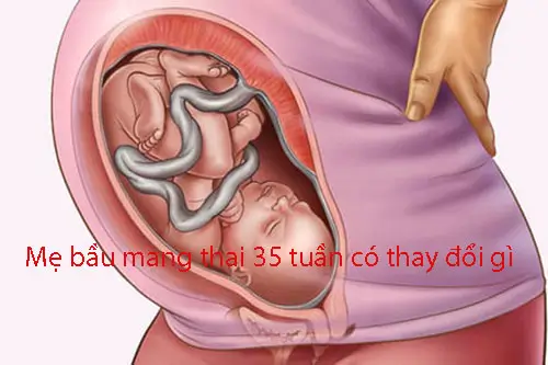 Mẹ bầu mang thai 35 tuần có thay đổi gì