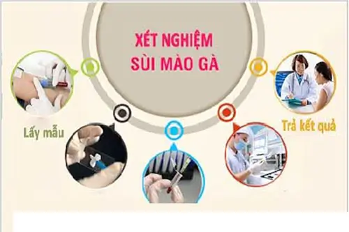 Quy trình xét nghiệm sùi mào gà