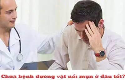 Điều trị dương vật nổi mụn ở đâu tốt?