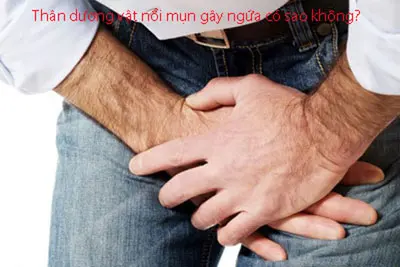 Thân dương vật nổi mụn gây ngứa có sao không?
