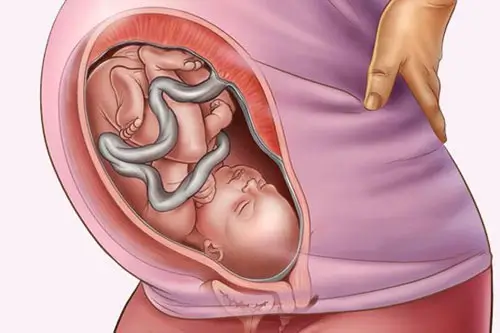 Sự phát triển của thai 36 tuần