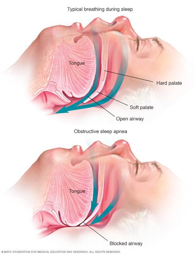 A diagram of a person's throatDescription automatically generated