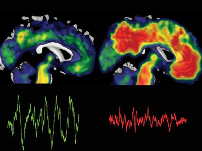 A close-up of a brain scanDescription automatically generated
