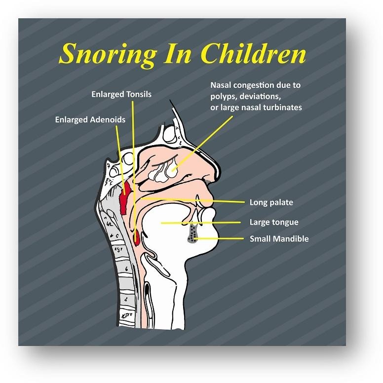 A diagram of the nose and throatDescription automatically generated