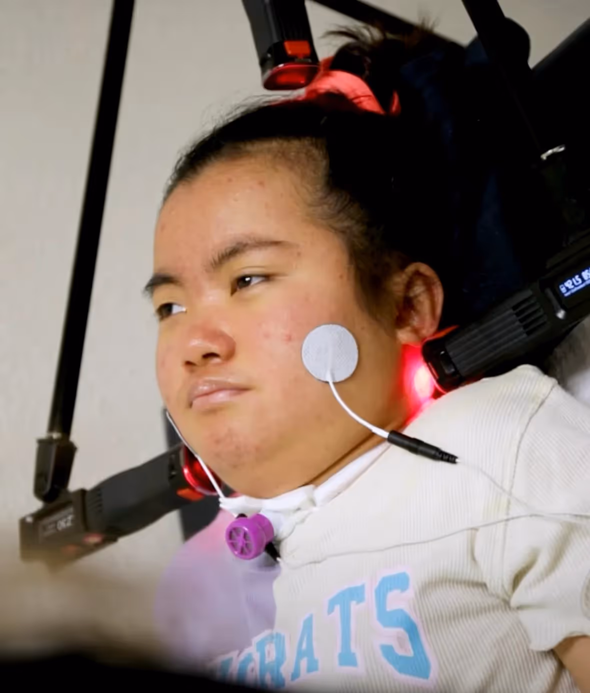 Aliana's story of treating and recovering from Seizures with the help of doctors and advanced methods at NeuroSolution in Austin, Texas.