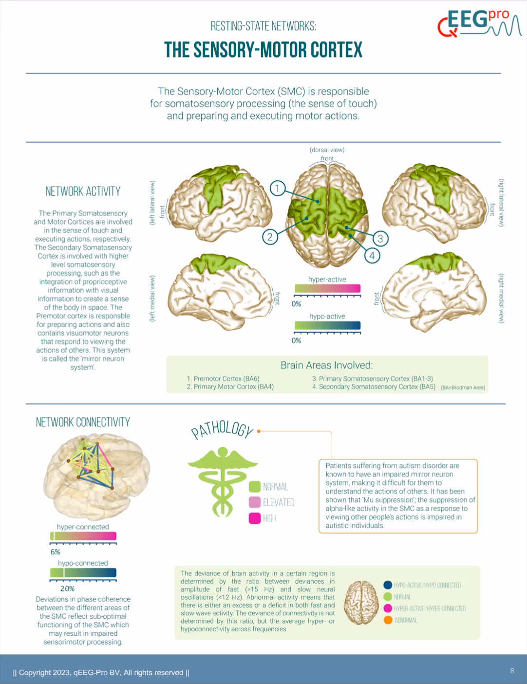 Most recent QEEG analysis demonstrating normalization of the sensory-motor cortex