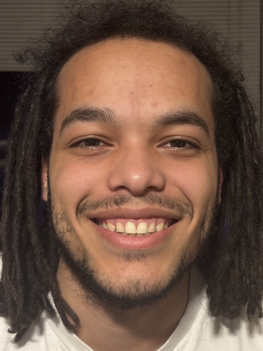 Tyson Dillon