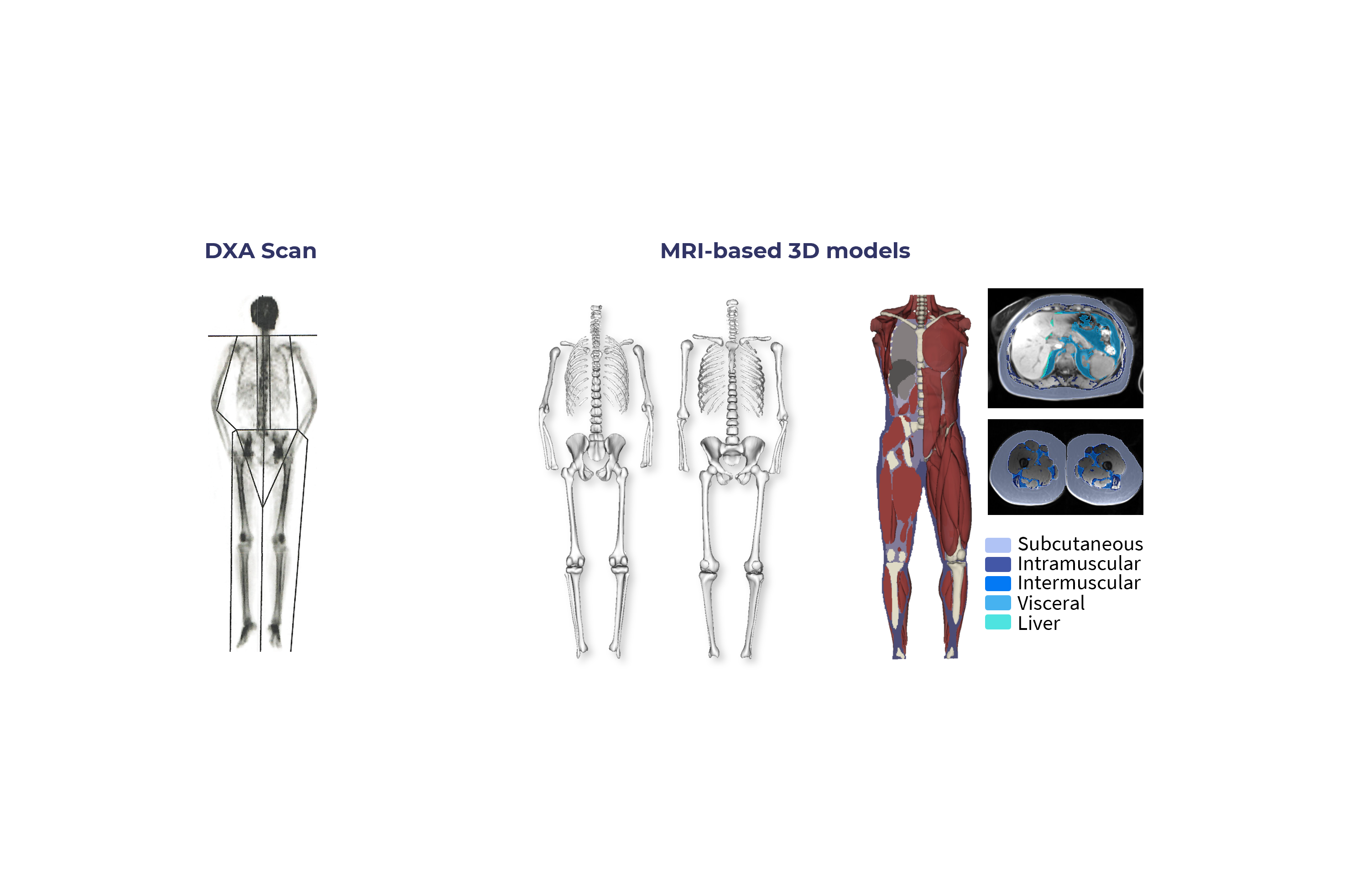 Whitepaper - Validity of Body Composition Measurement and Its Clinical Applications 