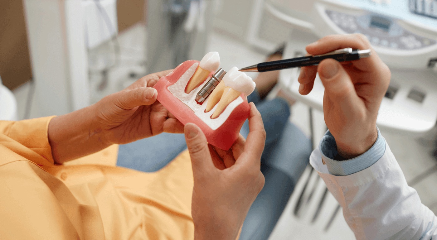 Thinking About Dental Implants? Here’s What You Need to Know