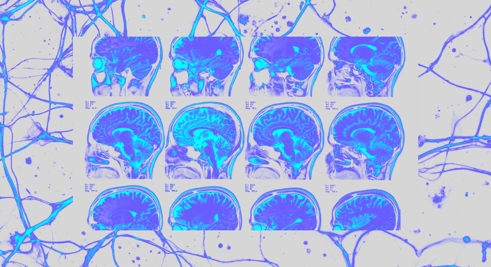 Neuroscience of Learning and Memory Study for Brain Preservation