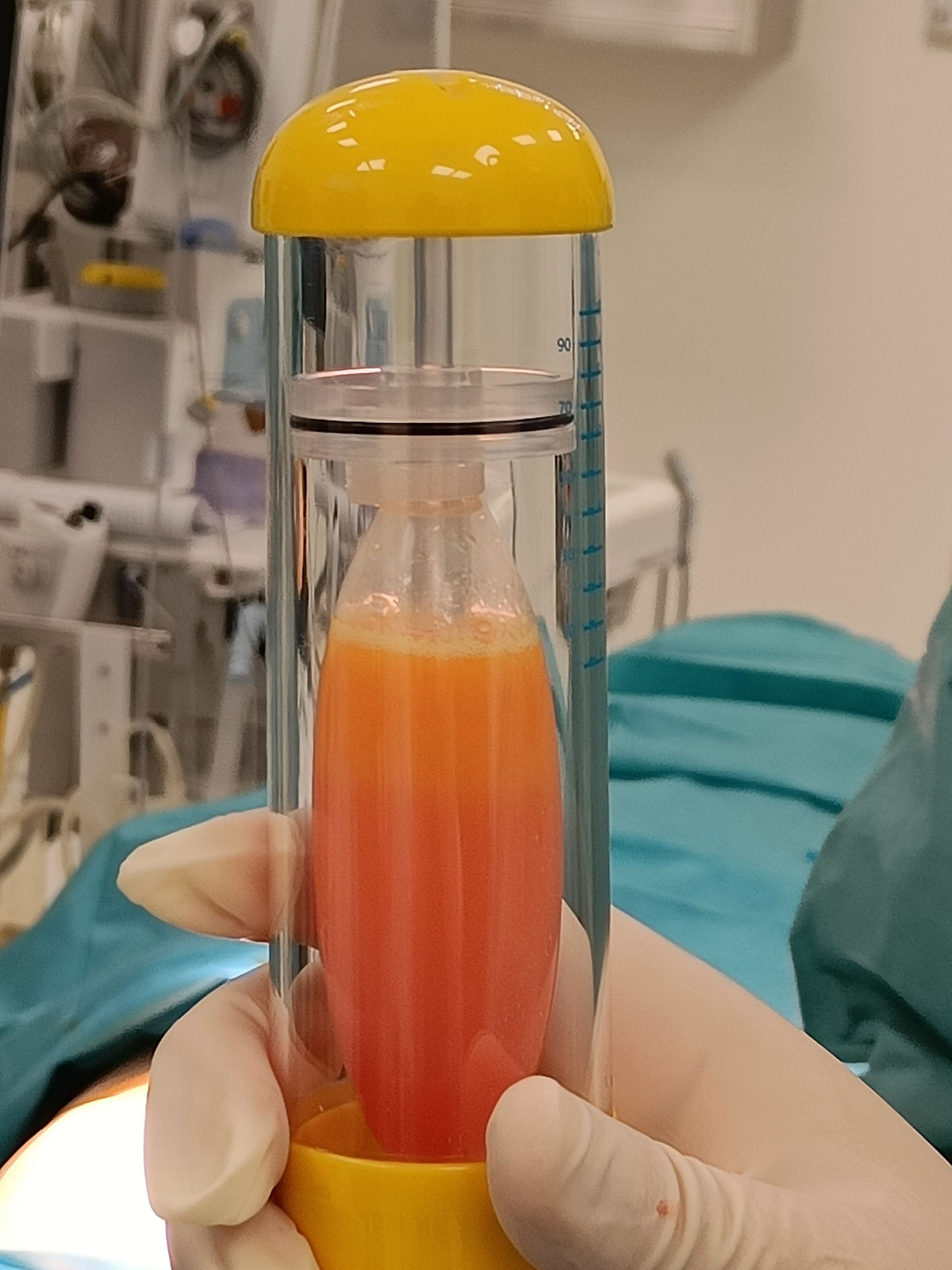 Kako izgleda proces ekstrakcije i primjene matičnih stanica iz masnog tkiva?