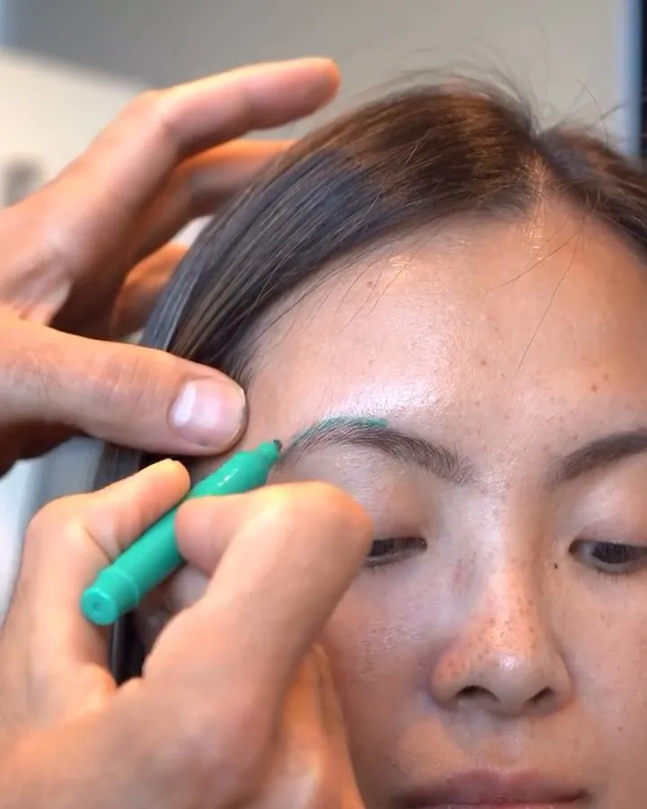 Dr. Buonassisi marking brow lift incision options on a model