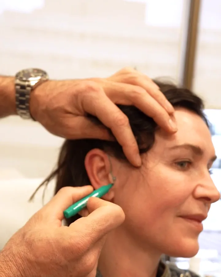 Dr. Buonassisi marking facelift incision lines at a woman's hairline and ear