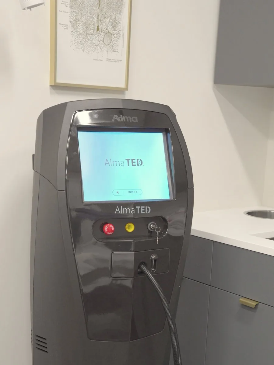 The TED device in a treatment room at 8 West Clinic, beside a drawing of a hair follicle
